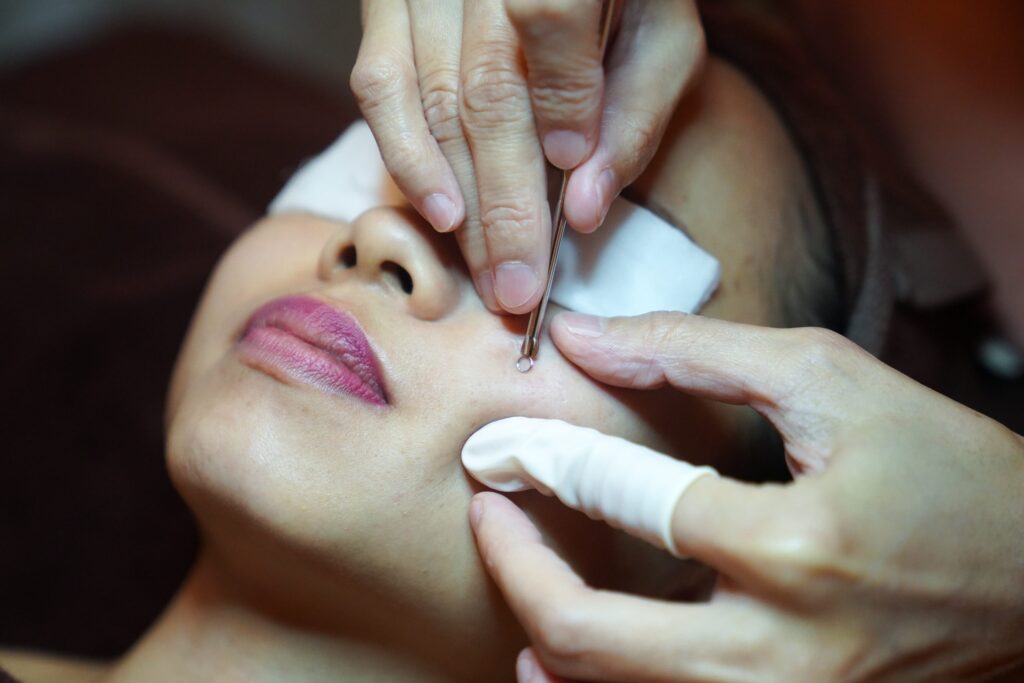 Best Extraction Facial