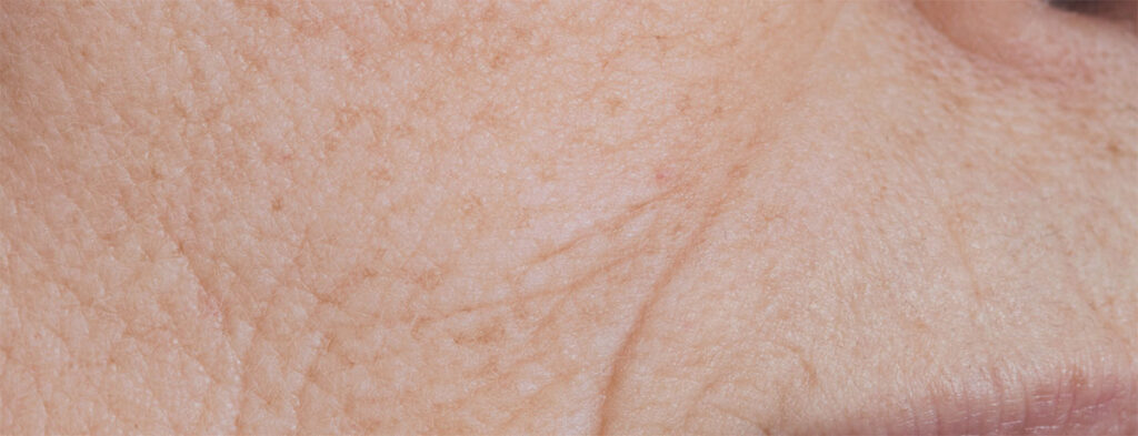 Anti Aging Facial Treatment Singapore