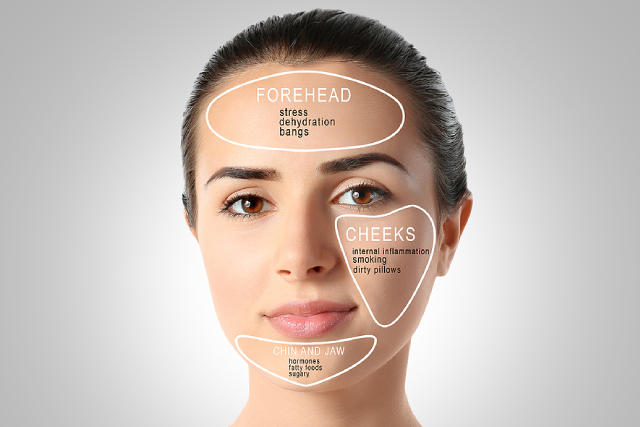 Understanding Your Skin: Where Your Acne Appears Matters