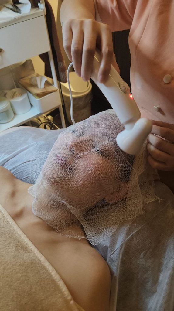 Best Extraction Facial Review By Simply Mommie post-extraction care