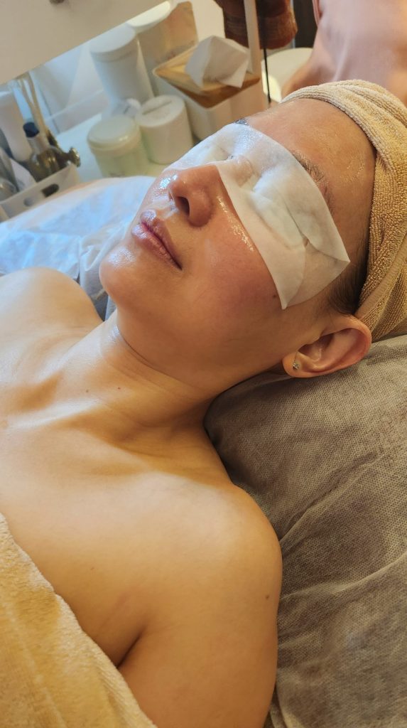 Best Extraction Facial Review By Simply Mommie RF eye treatment