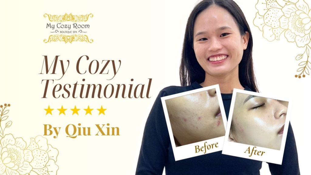 From Congested to Crystal Clear: My Cozy Room’s Ultimate Pore Extraction Facial Review
