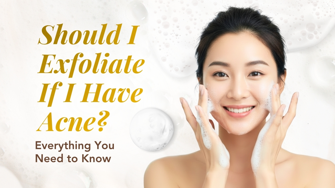 Should I Exfoliate If I Have Acne