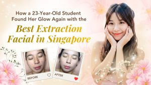 How a 23-Year-Old Student Found Her Glow Again with the Best Extraction Facial in Singapore