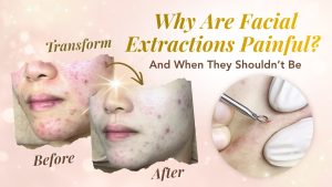 Why Are Facial Extractions Painful? (And When They Shouldn’t Be)