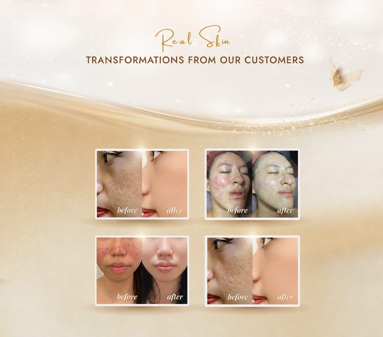 Existing transformation panel 1, with before and after together