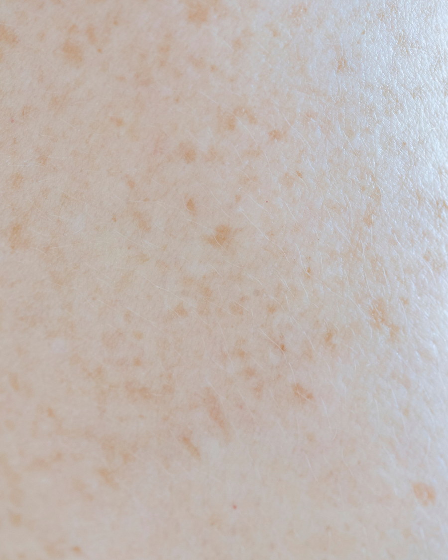 Hydrating facial for dull and dehydrated skin in Singapore